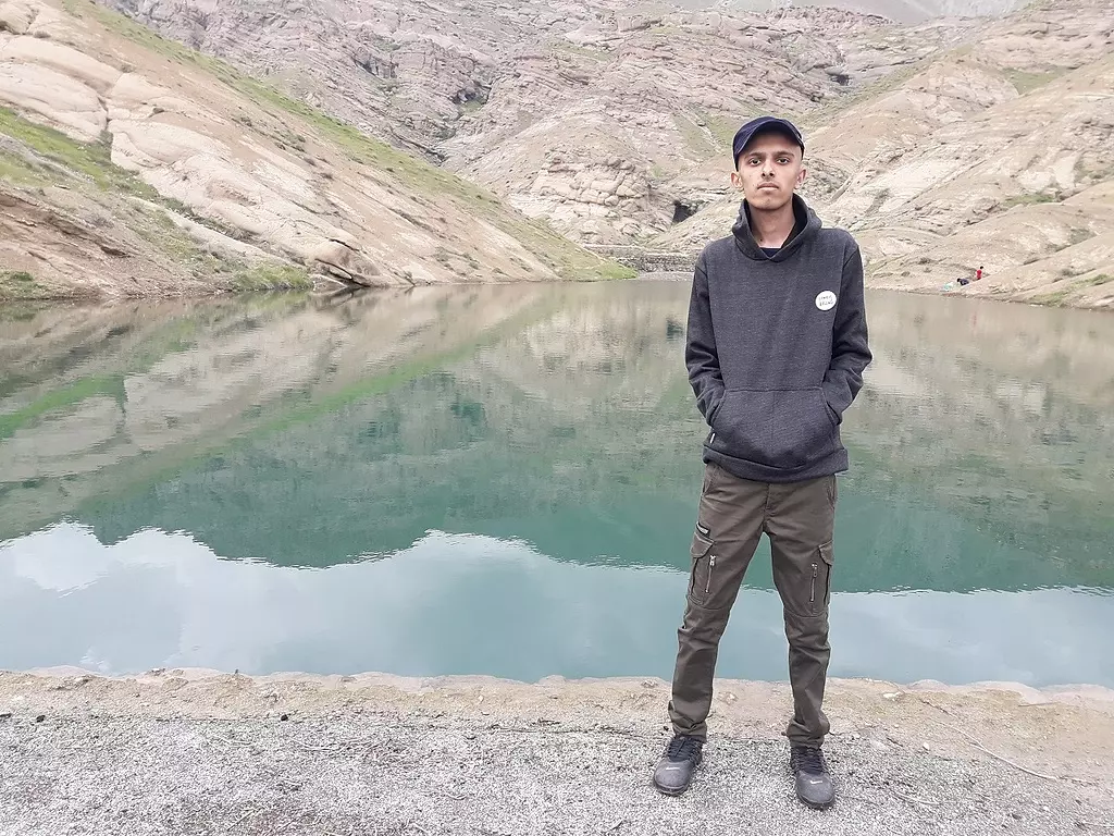 Vardij Dam — (10 days after the fourth chemotherapy session)